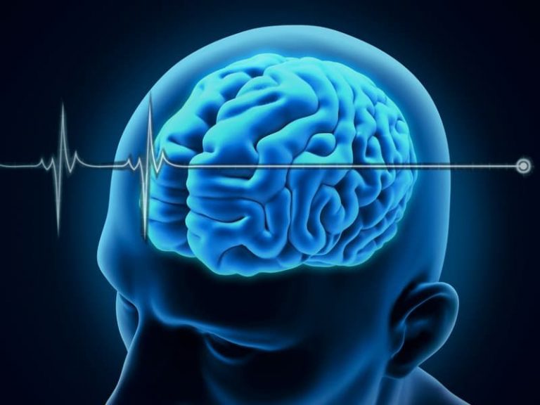 what-is-brain-death-compressed